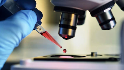 Investigadores del Conicet descubrieron un nuevo biomarcador para diagnosticar el hígado graso